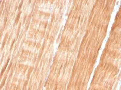 Immunohistochemistry-Paraffin: Alpha Actinin 2 Antibody (ACTN2/3293) - Azide and BSA Free [NBP2-79839]