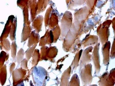 Immunohistochemistry-Paraffin: Alpha Actinin 2 Antibody (ACTN2/3293) - Azide and BSA Free [NBP2-79839]