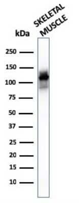 Western Blot: Alpha Actinin 2 Antibody (ACTN2/3293)Azide and BSA Free [NBP2-79839]