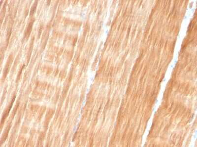 Immunohistochemistry-Paraffin: Alpha Actinin 2 Antibody (ACTN2/3293) [NBP2-79705]