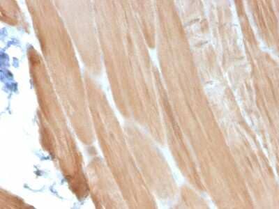 Immunohistochemistry-Paraffin: Alpha Actinin 2 Antibody (ACTN2/3293) [NBP2-79705]