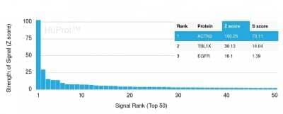 Protein Array: Alpha Actinin 2 Antibody (ACTN2/3293) [NBP2-79705]