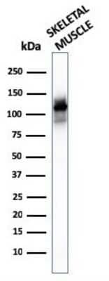 Western Blot: Alpha Actinin 2 Antibody (ACTN2/3293) [NBP2-79705]