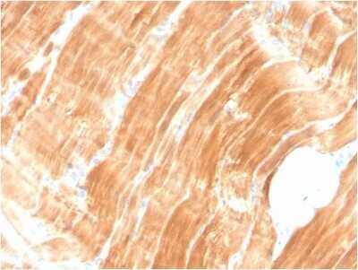 Immunohistochemistry-Paraffin: Alpha Actinin 2 Antibody (ACTN2/3294) [NBP3-07466]