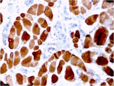 Immunohistochemistry-Paraffin: Alpha Actinin 2 Antibody (ACTN2/3294) [NBP3-07466]