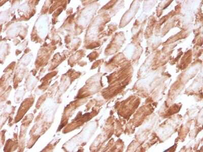 Immunohistochemistry-Paraffin: Alpha Actinin 2 Antibody (ACTN2/3294) [NBP3-07466]