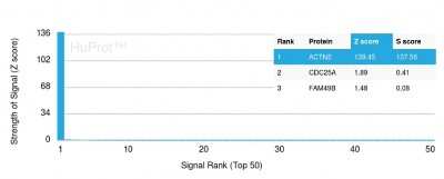 Protein Array: Alpha Actinin 2 Antibody (ACTN2/3294) - Azide and BSA Free [NBP3-08787]