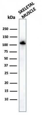 Western Blot: Alpha Actinin 2 Antibody (ACTN2/3294) [NBP3-07466]