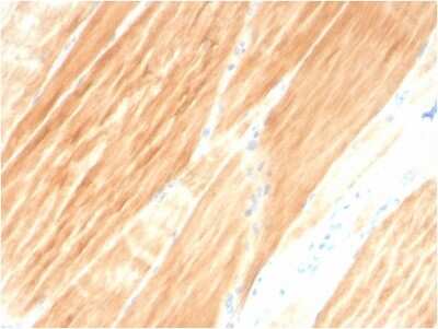 Immunohistochemistry-Paraffin: Alpha Actinin 2 Antibody (ACTN2/3295) - Azide and BSA Free [NBP3-08788]