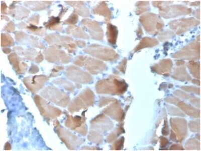 Immunohistochemistry-Paraffin: Alpha Actinin 2 Antibody (ACTN2/3295) - Azide and BSA Free [NBP3-08788]
