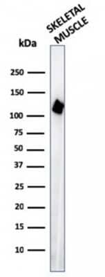 Western Blot: Alpha Actinin 2 Antibody (ACTN2/3295)Azide and BSA Free [NBP3-08788]