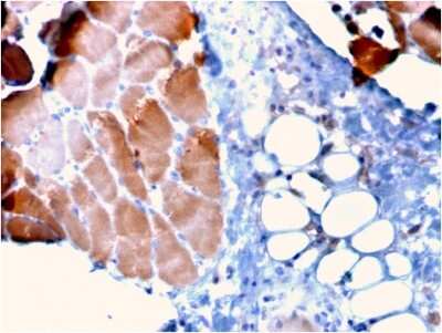 Immunohistochemistry-Paraffin: Alpha Actinin 2 Antibody (ACTN2/3295) [NBP3-07467]