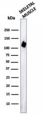 Western Blot: Alpha Actinin 2 Antibody (ACTN2/3295) [NBP3-07467]