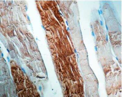 Immunohistochemistry-Paraffin: Alpha Actinin 2 Antibody (EA-53) [NBP1-22630]