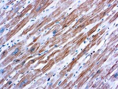 Immunohistochemistry-Paraffin: Alpha Actinin 2 Antibody (EA-53) [NBP1-22630]