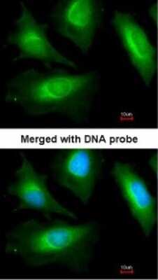 Immunocytochemistry/ Immunofluorescence: Alpha Actinin 2 Antibody [NBP2-15355]