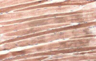 Immunohistochemistry-Paraffin: Alpha Actinin 2 Antibody [NBP1-32462]