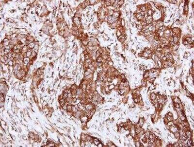 Immunohistochemistry-Paraffin: Alpha Actinin 2 Antibody [NBP2-15355]