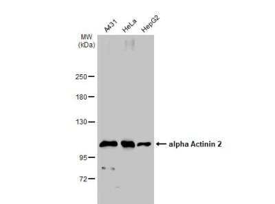 Western Blot: Alpha Actinin 2 Antibody [NBP1-32462]