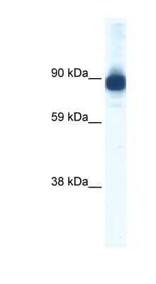 Western Blot: Alpha Actinin 2 Antibody [NBP1-80254]