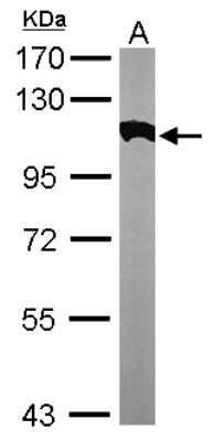Western Blot: Alpha Actinin 2 Antibody [NBP2-15355]