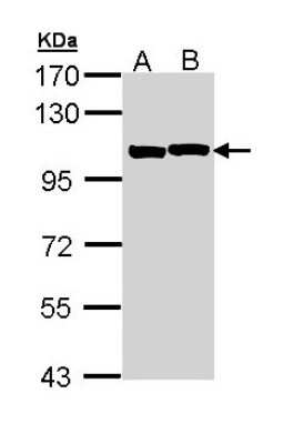 Western Blot: Alpha Actinin 2 Antibody [NBP2-15355]