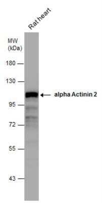 Western Blot: Alpha Actinin 2 Antibody [NBP2-15355]