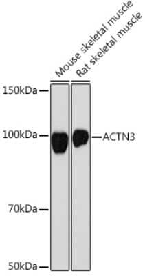 Western Blot: Alpha Actinin 3 Antibody (4H7E6) [NBP3-15827]