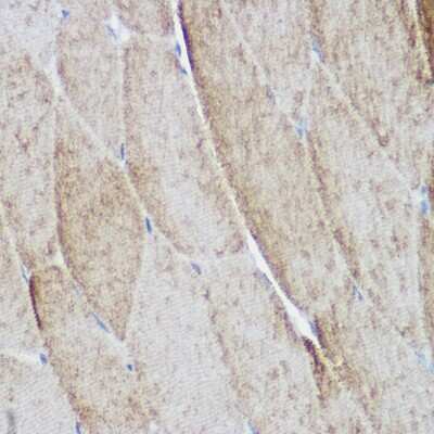 Immunohistochemistry-Paraffin: Alpha Actinin 3 Antibody - Azide and BSA Free [NBP2-92608]
