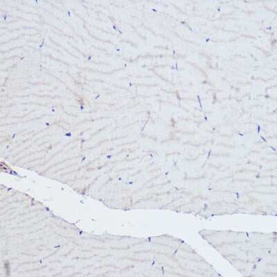 Immunohistochemistry-Paraffin: Alpha Actinin 3 Antibody - Azide and BSA Free [NBP2-92608]