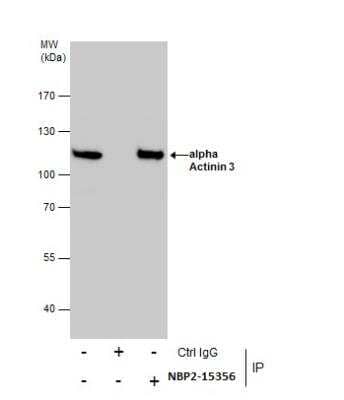 Immunoprecipitation: Alpha Actinin 3 Antibody [NBP2-15356]