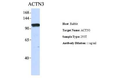 Western Blot: Alpha Actinin 3 Antibody [NBP1-55292]