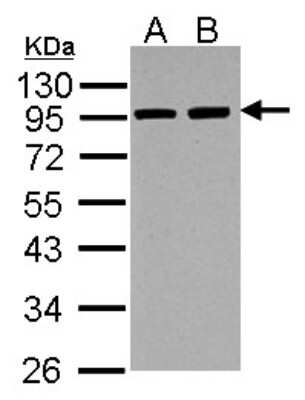 Western Blot: Alpha Actinin 3 Antibody [NBP2-15356]