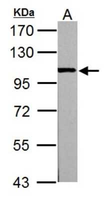 Western Blot: Alpha Actinin 3 Antibody [NBP2-15356]