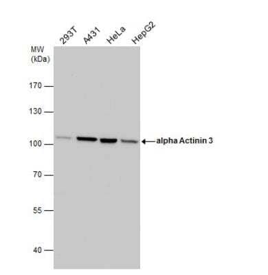 Western Blot: Alpha Actinin 3 Antibody [NBP2-15356]