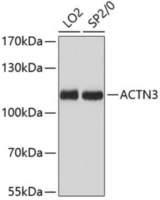 Western Blot: Alpha Actinin 3 AntibodyAzide and BSA Free [NBP2-92608]