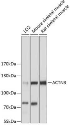 Western Blot: Alpha Actinin 3 AntibodyAzide and BSA Free [NBP2-92610]