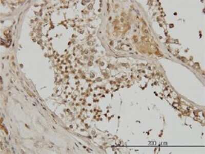 Immunohistochemistry-Paraffin: Alpha Actinin 4 Antibody (4D10) [H00000081-M01]