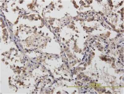 Immunohistochemistry-Paraffin: Alpha Actinin 4 Antibody (4D10) [H00000081-M01]