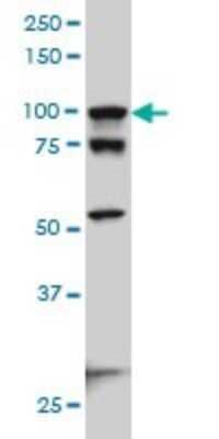 Western Blot: Alpha Actinin 4 Antibody (4D10) [H00000081-M01]
