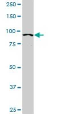Western Blot: Alpha Actinin 4 Antibody (4D10) [H00000081-M01]