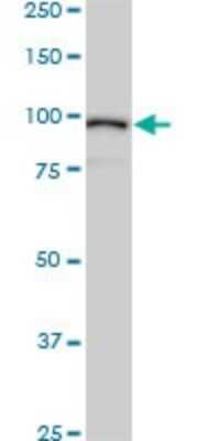 Western Blot: Alpha Actinin 4 Antibody (4D10) [H00000081-M01]
