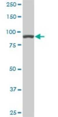 Western Blot: Alpha Actinin 4 Antibody (4D10) [H00000081-M01]