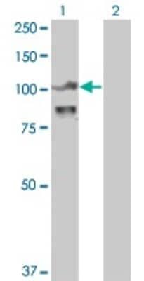 Western Blot: Alpha Actinin 4 Antibody (4D10) [H00000081-M01]