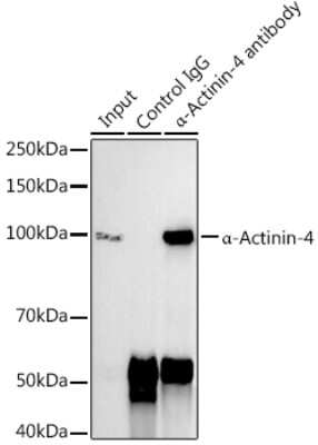 Immunoprecipitation: Alpha Actinin 4 Antibody (5Y3R6) [NBP3-16176]