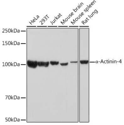 Western Blot: Alpha Actinin 4 Antibody (5Y3R6) [NBP3-16176]