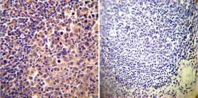 Immunohistochemistry-Paraffin: Alpha Actinin 4 Antibody (7H6) [NB100-74352]