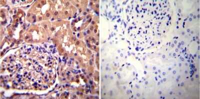 Immunohistochemistry-Paraffin: Alpha Actinin 4 Antibody (7H6) [NB100-74352]