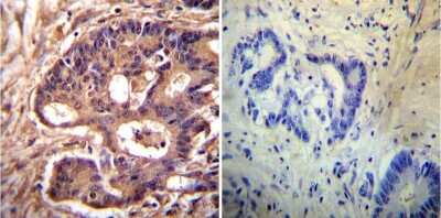 Immunohistochemistry-Paraffin: Alpha Actinin 4 Antibody (7H6) [NB100-74352]