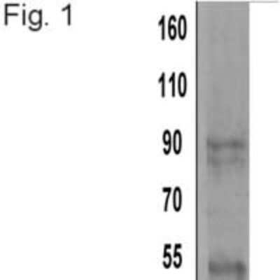 Western Blot: Alpha Actinin 4 Antibody (7H6) [NB100-74352]